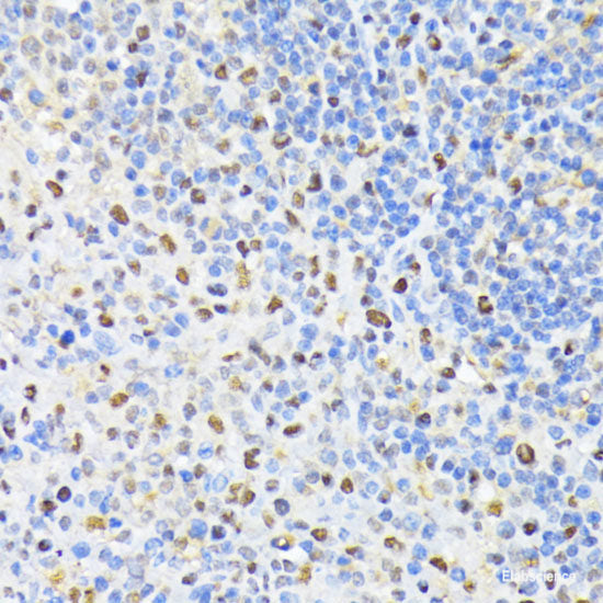 Immunohistochemistry of paraffin-embedded Rat lung using CSNK2A2 Polyclonal Antibody at dilution of  1:100 (40x lens).
