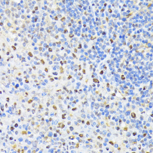 Immunohistochemistry of paraffin-embedded Rat lung using CSNK2A2 Polyclonal Antibody at dilution of  1:100 (40x lens).