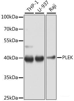 Immunohistochemistry of paraffin-embedded Human mammary gland using CTSS Polyclonal Antibody at dilution of  1:200 (40x lens).