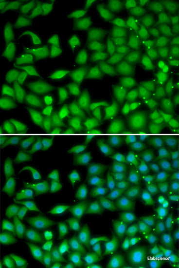 Immunohistochemistry of paraffin-embedded Mouse lung using GSS Polyclonal Antibody at dilution of  1:200 (40x lens).