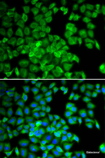 Immunohistochemistry of paraffin-embedded Human esophagus using IL7R Polyclonal Antibody at dilution of  1:100 (40x lens).