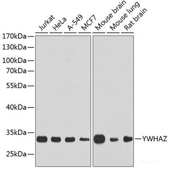 Immunohistochemistry of paraffin-embedded Human tonsil using CD44 Polyclonal Antibody at dilution of  1:200 (40x lens).