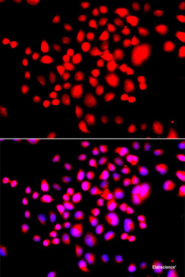 Immunohistochemistry of paraffin-embedded Mouse spleen using NOTCH3 Polyclonal Antibody at dilution of  1:100 (40x lens).