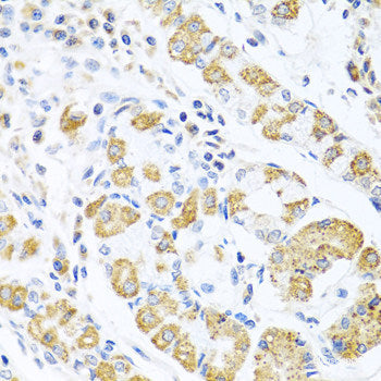Immunohistochemistry of paraffin-embedded Human colon using PSMA4 Polyclonal Antibody at dilution of  1:100 (40x lens).