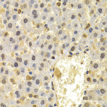 Immunohistochemistry of paraffin-embedded Rat testis using PVALB Polyclonal Antibody at dilution of  1:100 (40x lens).
