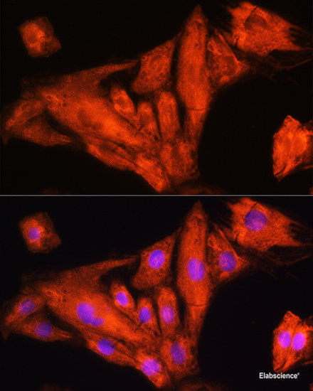 Immunohistochemistry of paraffin-embedded Mouse liver using ST14 Polyclonal Antibody at dilution of  1:200 (40x lens).