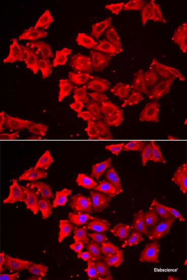 Immunohistochemistry of paraffin-embedded Mouse liver using CETP Polyclonal Antibody 