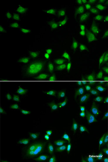 Immunohistochemistry of paraffin-embedded Rat liver using UGDH Polyclonal Antibody at dilution of  1:100 (40x lens).