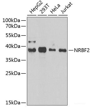 Immunohistochemistry of paraffin-embedded Human kidney cancer using HAUSP / USP7 Polyclonal Antibody at dilution of  1:200 (40x lens).