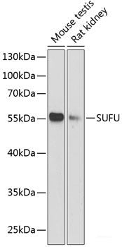 Immunohistochemistry of paraffin-embedded Human colon using PICK1 Polyclonal Antibody at dilution of  1:100 (40x lens).
