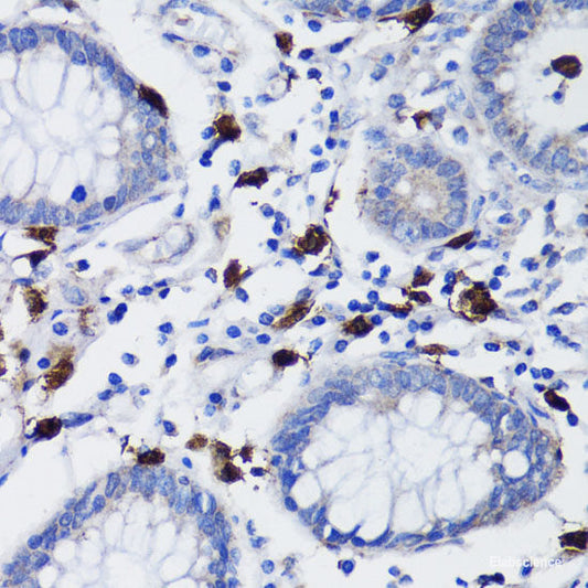 Immunofluorescence analysis of HeLa cells using CD177 Polyclonal Antibody