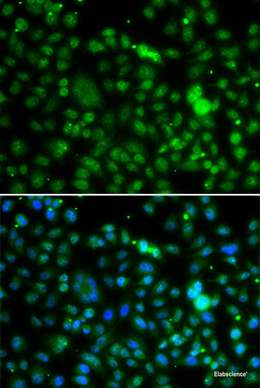 Immunohistochemistry of paraffin-embedded Rat testis using APOBEC3G Polyclonal Antibody at dilution of  1:100 (40x lens).