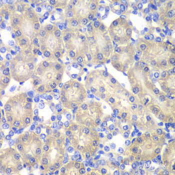 Immunohistochemistry of paraffin-embedded Rat brain using WNT3A Polyclonal Antibody at dilution of  1:200 (40x lens).