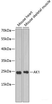 Immunohistochemistry of paraffin-embedded Rat lung using TICAM1 Polyclonal Antibody at dilution of  1:100 (40x lens).