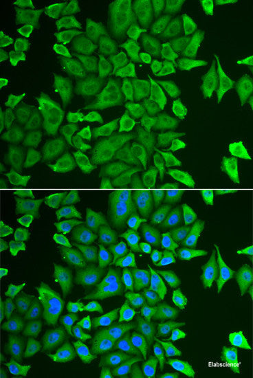 Western blot analysis of extracts of 293T cells using FIGF Polyclonal Antibody at dilution of 1:1000.