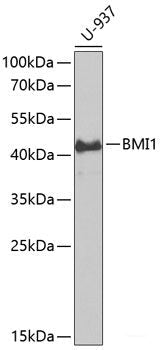 Immunohistochemistry of paraffin-embedded Mouse lung using PRKCB Polyclonal Antibody at dilution of  1:200 (40x lens).