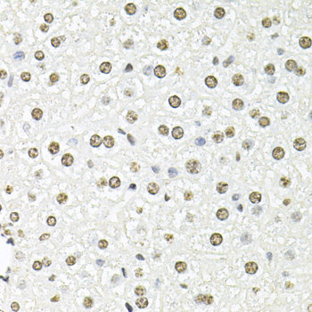 Immunohistochemistry of paraffin-embedded Rat brain using CPA6 Polyclonal Antibody at dilution of  1:100 (40x lens).