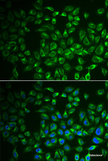 Immunohistochemistry of paraffin-embedded Human esophagus using INTS5 Polyclonal Antibody at dilution of  1:100 (40x lens).