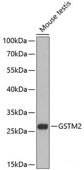 Western blot analysis of extracts of various cell lines using RRM1 Polyclonal Antibody at dilution of 1:1000.