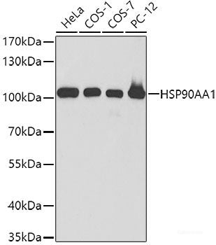 Immunohistochemistry of paraffin-embedded Rat testis using GLB1 Polyclonal Antibody at dilution of  1:200 (40x lens).