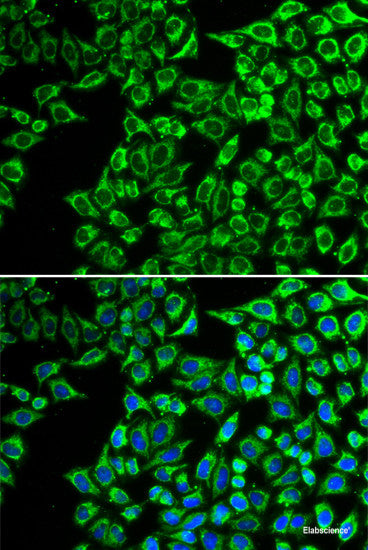 Immunohistochemistry of paraffin-embedded Mouse lung using CARS Polyclonal Antibody at dilution of  1:100 (40x lens).