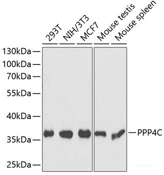 Immunohistochemistry of paraffin-embedded Human breast cancer using CABP7 Polyclonal Antibody at dilution of  1:100 (40x lens).
