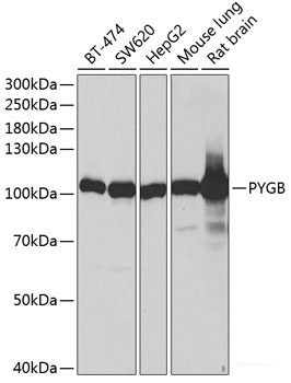 Western blot analysis of extracts of various cell lines using DOK5 Polyclonal Antibody at dilution of 1:3000.