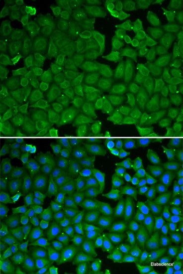 Immunohistochemistry of paraffin-embedded Mouse spleen using MPO Polyclonal Antibody at dilution of  1:100 (40x lens).