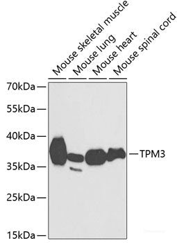 Western blot analysis of extracts of Raji cells using ZC3H10 Polyclonal Antibody at dilution of 1:3000.