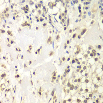 Immunohistochemistry of paraffin-embedded Rat liver using HSF1 Polyclonal Antibody at dilution of  1:100 (40x lens).