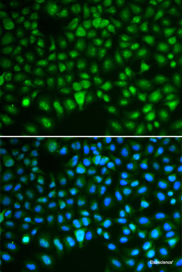 Immunohistochemistry of paraffin-embedded Rat liver using F3 Polyclonal Antibody at dilution of  1:100 (40x lens).