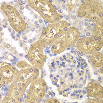Immunofluorescence analysis of C6 cells using ABCB10 Polyclonal Antibody at dilution of  1:100. Blue: DAPI for nuclear staining.