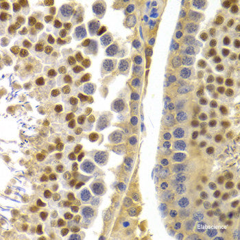 Immunohistochemistry of paraffin-embedded Rat brain using GANAB Polyclonal Antibody at dilution of  1:150 (40x lens).