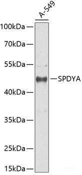 Western blot analysis of extracts of Mouse brain using GRIN2A Polyclonal Antibody at dilution of 1:3000.