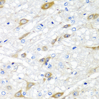 Immunohistochemistry of paraffin-embedded Rat lymph node using SNAP23 Polyclonal Antibody at dilution of  1:100 (40x lens).