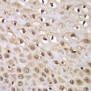 Immunofluorescence analysis of U2OS cells using ADA Polyclonal Antibody at dilution of  1:100. Blue: DAPI for nuclear staining.