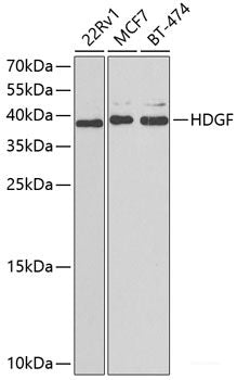 Immunohistochemistry of paraffin-embedded Rat brain using KNG1 Polyclonal Antibody at dilution of  1:100 (40x lens).