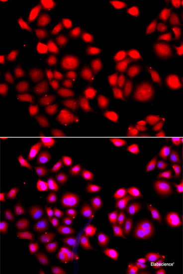 Immunohistochemistry of paraffin-embedded Rat spinal cord using PHLDA2 Polyclonal Antibody at dilution of  1:100 (40x lens).