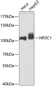 Immunohistochemistry of paraffin-embedded Human colon using MCAM Polyclonal Antibody at dilution of  1:100 (40x lens).