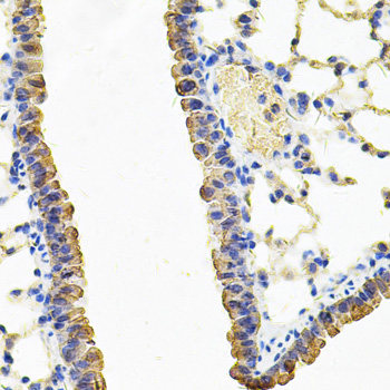 Immunofluorescence analysis of 293T cells using AADAC Polyclonal Antibody at dilution of  1:100 (40x lens). Blue: DAPI for nuclear staining.