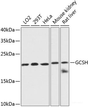 Immunohistochemistry of paraffin-embedded Rat brain using RhoA Polyclonal Antibody at dilution of  1:100 (40x lens).