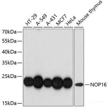 Western blot analysis of extracts of various cell lines using AGER Polyclonal Antibody at dilution of 1:1000.