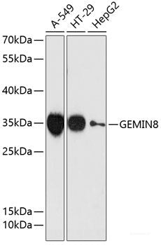 Immunohistochemistry of paraffin-embedded Rat trachea using COMP Polyclonal Antibody at dilution of  1:100 (40x lens).