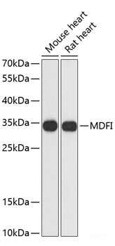 Immunofluorescence analysis of HeLa cells using CYP1B1 Polyclonal Antibody at dilution of  1:100 (40x lens). Blue: DAPI for nuclear staining.