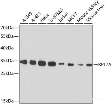 Immunohistochemistry of paraffin-embedded Rat brain using CYP17A1 Polyclonal Antibody at dilution of  1:100 (40x lens).
