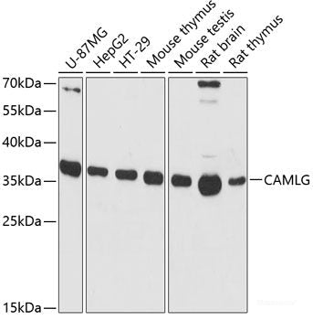 Immunohistochemistry of paraffin-embedded Human liver using DBH Polyclonal Antibody at dilution of  1:200 (40x lens).