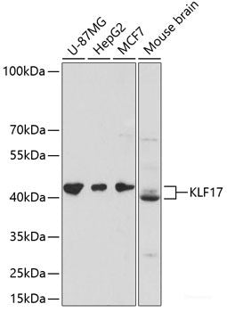 Immunohistochemistry of paraffin-embedded Rat brain using GRIN1 Polyclonal Antibody at dilution of  1:100 (40x lens).