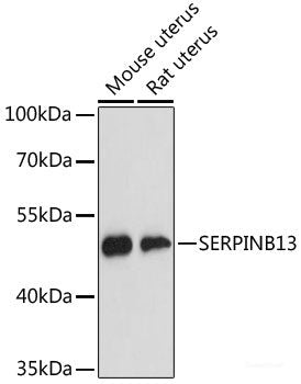 Immunohistochemistry of paraffin-embedded Rat ovary using HLA-DPB1 Polyclonal Antibody at dilution of  1:100 (40x lens).