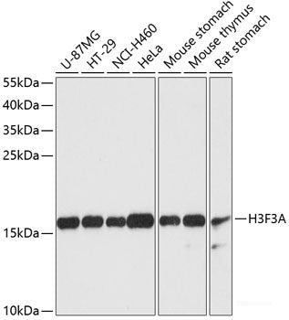 Immunohistochemistry of paraffin-embedded Rat brain using OTX2 Polyclonal Antibody at dilution of  1:100 (40x lens).