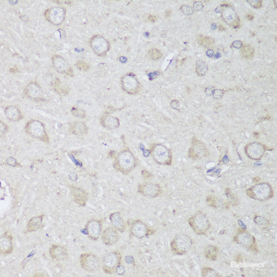 Immunofluorescence analysis of C6 cells using PTPN22 Polyclonal Antibody at dilution of  1:100. Blue: DAPI for nuclear staining.